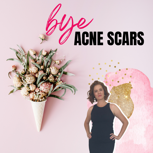Best treatment for acne scars