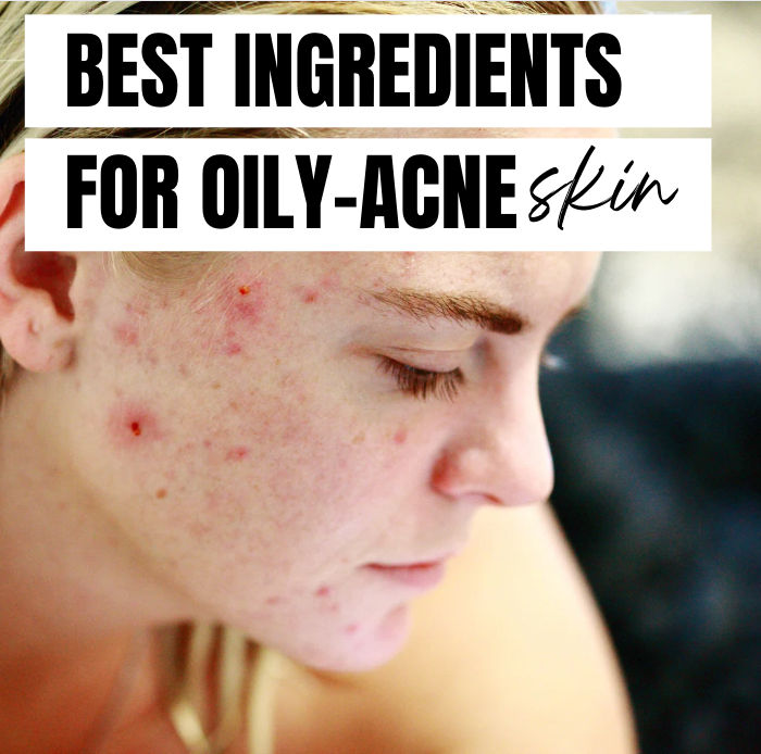 The best ingredients for oily and acne prone skin